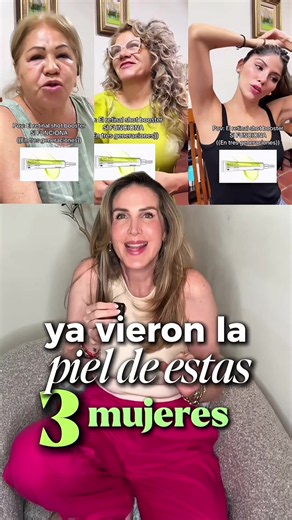 Para mí el mejor activo antienvejecimiento es el retinal porque es más efectivo que el retinol y menos agresivo y ayuda muchísimo a la producción de colágeno que es el encargado de mantener nuestra piel más firme y con menos arrugas, manchas y líneas de expresión. Links autorizados por celimax En México https://a.co/d/0882YZHH En otros países https://www.yesstyle.com/en/celimax-the-vita-a-retinal-shot-tightening-booster-15ml/info.html/pid.1130946339 @celimax.latam #retinal #celimax #skincare #se