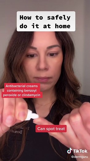 How to Safely Pop a Pimple at Home