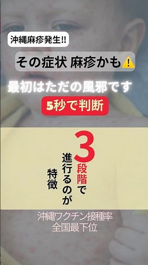⚠️その症状 麻疹かも #麻疹症状 #はしか症状 #発熱 #受診目安 #沖縄ママ
