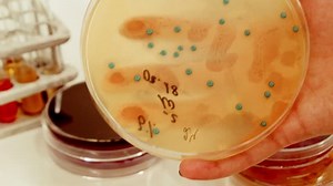 Cultures spores close up in research laboratory. Few samples and taking in hands culture