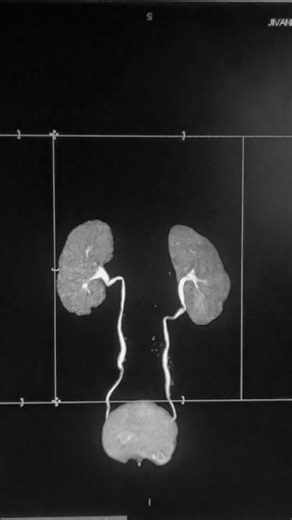 CT Urography. #radiology #viral #trend #shortsfeed #shortsviral #shortfeed #remix #anatomy #avtar