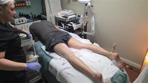 [Day 667] 🪩 [6.... 6..... 7! - Leg hair removal stream - Extreme Run - !charity DAY 13] 🪩 [!Everydayathon @ !Live]