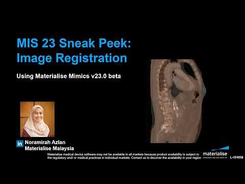 Sneak peek: Image Registration (Mimics Innovation Suite 23)