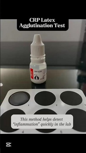 CRP Latex Agglutination Test - Quick Demo.serial dilutions to estimate CRP levels in our next video🧪