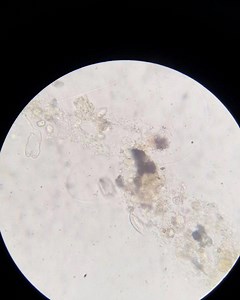 3.6K views · 19 reactions | Biofloc ready for our new shrimp! | RAS Aquaculture | Facebook