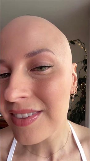 Yes of course it's a 'he' - the audacity says it all. #bald #alopecia