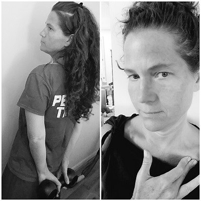 Clavicle or Shoulder Pain in Fibromyalgia - How Common Is It?