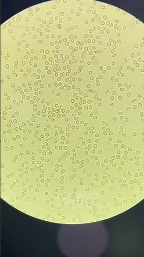Blood Cells Gone Wrong?🤔: Watch Crenation Under the Microscope!