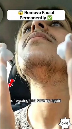 Best Remedy To Remove Unwanted Facial Hair | Facial Hair Removal At Home #facialhair #unwantedhair