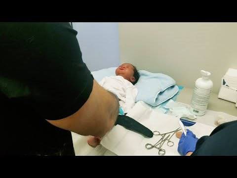 LIVE MALE CIRCUMCISION| Newborn goes under the knife to get permanent cosmetics| Surgery procedure