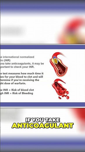 2-Minute Warfarin Monitoring: INR Targets, Side Effects & Management | Anticoagulation #shorts