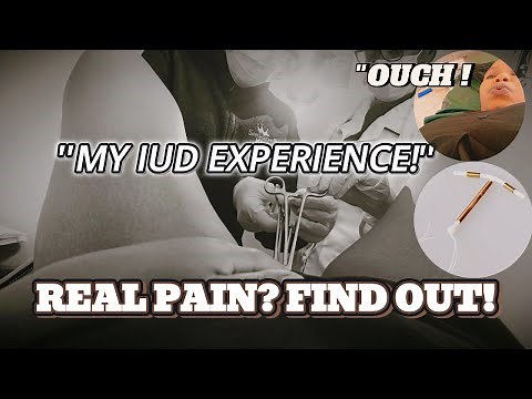 IUD EXPERIENCE||PAIN,SIDE EFFECTS||IS IT WORTH IT?FIND OUT