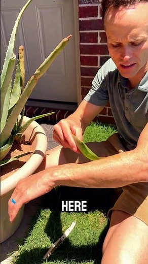 How to Use Aloe Vera for burns