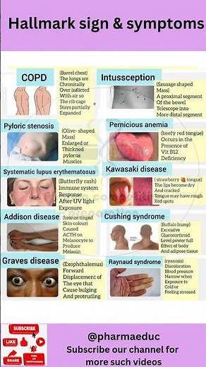 Top 10 Classic Medical Signs Every Nurse & Med Student Must Know! | Visual Guide