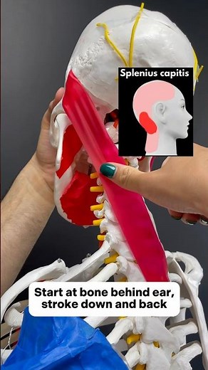 Head Pain Muscle Release Series Part 4- Splenius Capitis #headacherelief #headachetreatment #series