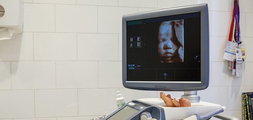 Does Planned Parenthood Do Ultrasounds? | HLI
