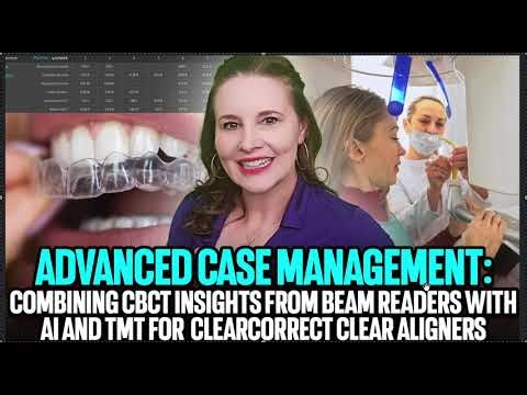 Workarounds for CBCT and Straumann ClearCorrect- Using A.I, Beam Readers and TMT