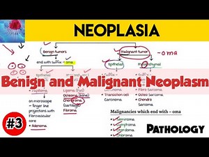Benign and Malignant Neoplasm - Neoplasia | Pathology