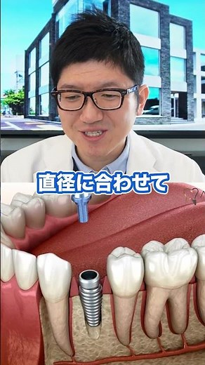The doctor explains the implant treatment process! [Yoshioka Dental Clinic]