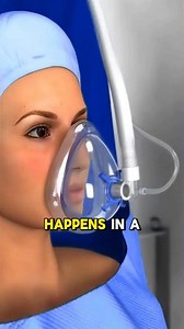 105K views · 1K reactions | Fallopian Tube Ligation (3D Animation) #FALLOPIAN #fallopiantube #ligation #fallopiantubeligation #3dmedicalanimation #medical3danimation | Medcare777 | Facebook