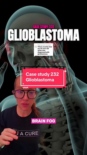 Replying to @Leann Case Study 232 | Glioblastoma (GBM) GBM is the most common malignant primary brain tumor in adults and unfortunately, one of the most aggressive. These tumors arise from glial cells within the brain and are known for growing rapidly, invading surrounding brain tissue, and developing their own blood supply. Unlike many other tumors, glioblastomas don't have clear borders, making them difficult to completely remove with surgery alone. Symptoms depend on where the tumor is locate