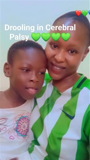 Happy world Cerebral Palsy day💚💚💚💚💚Let’s Talk About Drooling in Special Kids , Understand, Don’t Judge . Drooling is something we often see in children with Cerebral Palsy and other neurological conditions. But did you know... it’s not just about saliva? These kids aren’t drooling because they’re “messy” or “unhygienic.” They drool because of challenges with muscle control, swallowing, or even just being able to feel saliva in their mouth. It’s called oromotor dysfunction — their brain tell
