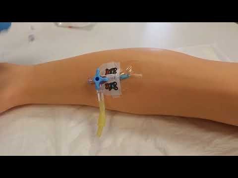 Administración de medicación intravenosa en bolo directo
