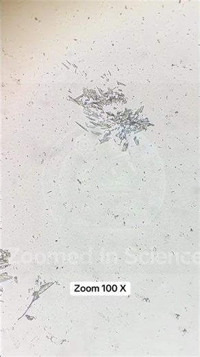 Bottle water under microscope! 💧🔬Shocking particles 🫣#BottledWater #Microscope #WaterFacts