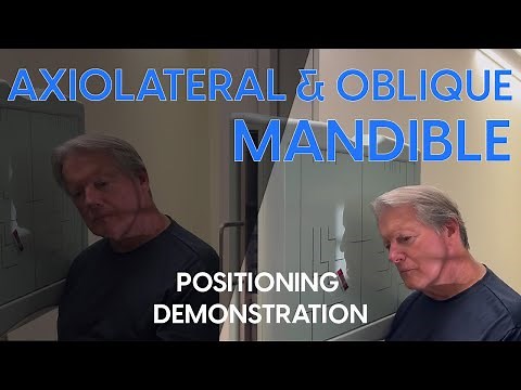 Axiolateral and Axiolateral Oblique Mandible Radiographic Positioning Demonstration