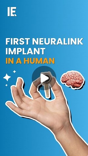 Interesting Engineering on Instagram: "Elon Musk's Neuralink has made a breakthrough by implanting a wireless brain chip in a human, marking a significant step in brain-computer interfaces. The procedure, approved by the FDA for a six-year study, involves implanting thin threads in the brain to facilitate device control through thought. #Neuralink #ElonMusk #BrainChip #BrainComputerInterface #FDAApproval"