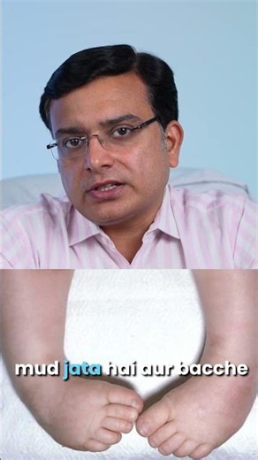 How Does Clubfoot Occur?