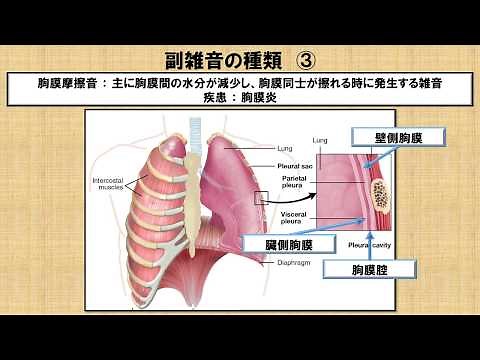 異常呼吸音副雑音に関する知識！？ ～No 73 理学療法士国家試験対策 シリーズ～