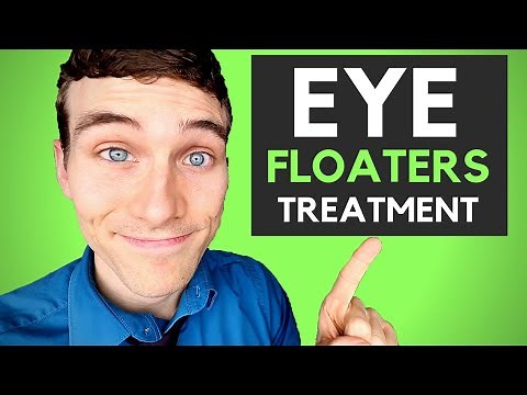 🔴How to Get Rid of Eye Floaters - 3 Eye Floaters Treatments
