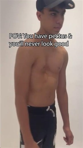 You Cant Look Good with Pectus Excavatum?