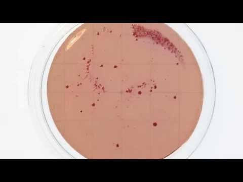 Crecimiento de enterobacterias en placa RODAC 24 horas 37ºC