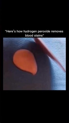 Hydrogen Peroxide Removes Blood StainsHydrogen peroxide by breaking down the proteins found in blood
