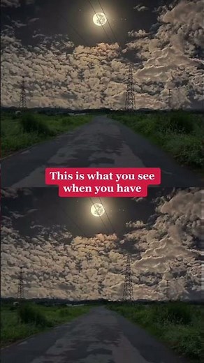 This is what you see when you have: Oscillopsia