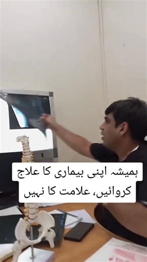 ⚠️ Sciatica Medicine Se Theek Kyun Nahi Hota? Sciatica ka asli masla disc ka nerve par pressure hota hai. Dard ki tablet, painkiller, balm, physiotherapy ya injections sirf symptoms ko chupate hain disease ko nahi! Is liye: ✔️ Dard wapas aa jata hai ✔️ Pair mein numbness/weakness barhti rehti hai ✔️ Nerve damage permanent ho sakta hai agar ilaj delay ho Asli treatment woh hota hai jo nerve ka pressure door kare. Modern options jaise: • Keyhole Endoscopic Discectomy (1 cm cut, fast recovery) • Mi
