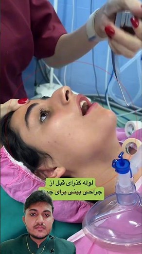 endotracheal tube #intubation #laryngoscope #trachea