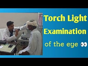 🔦Torch Light Examination Of The Eye Kya Hota hai ? || 🔦What Is Torch Light Examination Of The Eye ?💡