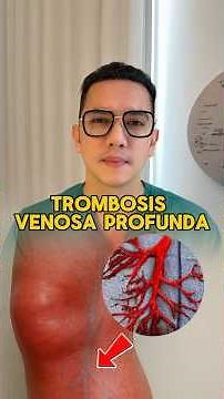 Trombosis venosa profunda: síntomas y factores de riesgo. #medicina #consejosdesalud #shorts