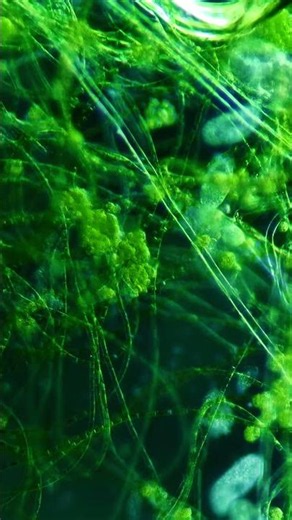 This Is Algae Under a Microscope! 🦠 (Darkfield 100x) #microcosmos