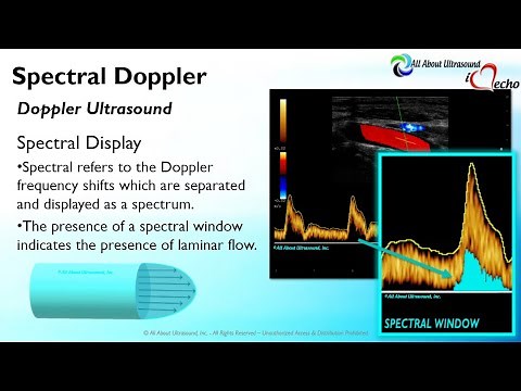 Doppler Principles: Spectral Doppler
