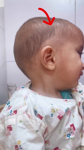 167K views · 832 reactions | Vitamin D Deficiency #drrizwangohar | Dr. Rizwan Gohar - Child Specialist - Pediatrician | Facebook