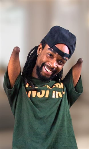 Doctors have no idea why I'm missing 3 limbs 😳 | Born Different