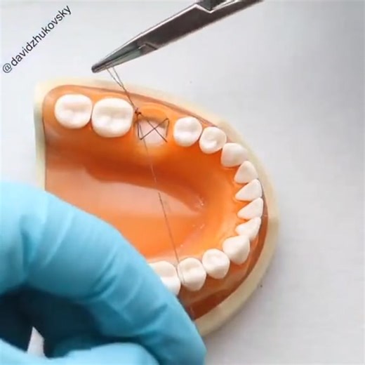 La procedure à suivre devant un cas qui presente un risque d'hemoragie . #dentistry #dentista #dental | Médecine Dentaire 09