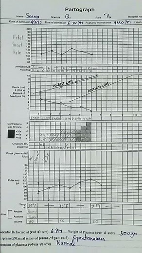 #Partograph📋/fill partograph of conduction of normal vaginal delivery 📉📌