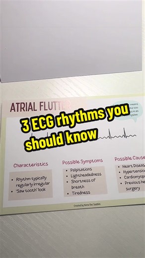 3 ECG Rhythms You Should Know — Identify Common Cardiac Rhythms