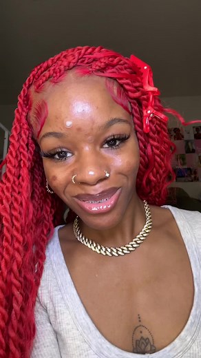 ZitSticka Pimple Patch Removal: Black Girl Acne Journey