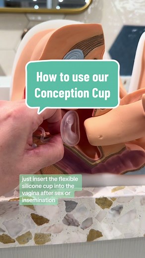 Our Conception Aid Cup is now available 🙌 And it’s the first of its kind to be cleared for at-home use in the US 🇺🇸 This flexible cup collects sperm and keeps it close to the cervix after sex or insemination when you’re trying to conceive. So if you’re JUST starting to try or if trying has become a little trying, it could be a good game plan, especially for people who have been diagnosed with: 💚 Low sperm count 💚 Sperm immobility 💚 An unfavorable vaginal environment Everyone’s journey is u